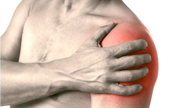 Een gezwollen, rode en vergrote schouder - symptomen van artrose van het schoudergewricht graad 2-3