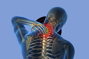Symptomen van cervicale osteochondrose