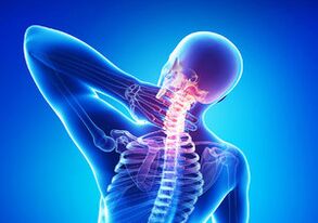 Tekenen van cervicale osteochondrose