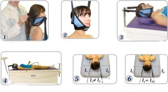 behandeling van cervicale osteochondrose met behulp van tractie