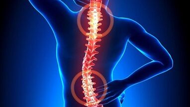 mechanisme voor de ontwikkeling van osteochondrose