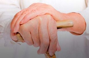 pijn in de gewrichten van de vingers bij reumatoïde artritis