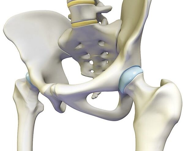 Osteochondrose veroorzaakt een scherpe pijn in het heupgewricht
