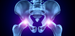 osteoartritis van het heupgewricht